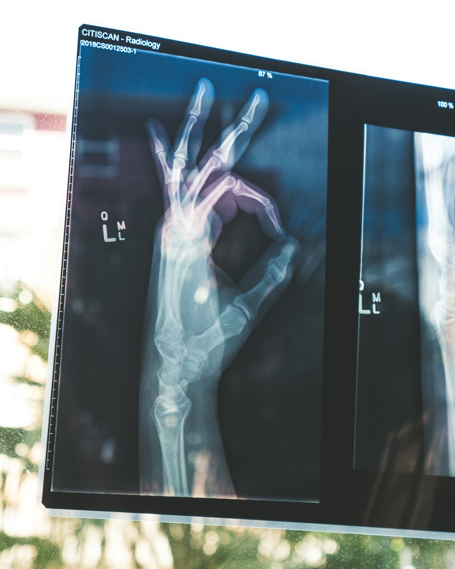 Die Rolle der digitalen Gesundheit in der modernen Medizin